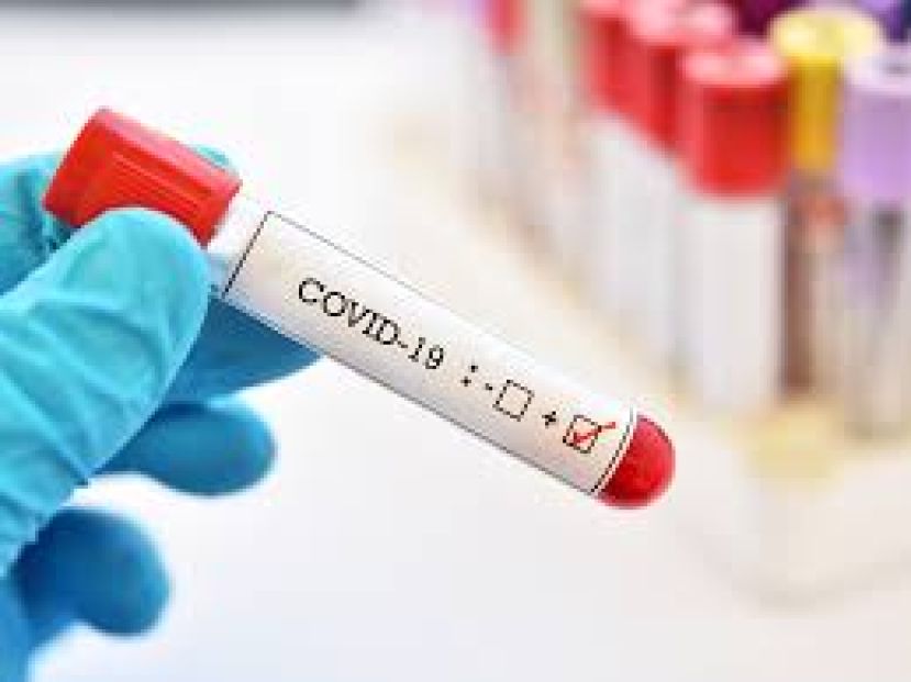 Covid: il contagio dilaga in Calabria, oggi 1.091 nuovi casi e 4 decessi